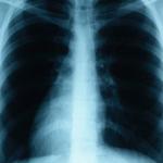 respiratorytherapist